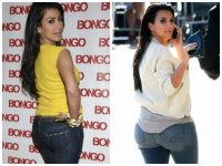 kim kardishan bbl before after.jpg kim kardishan bbl before after.jpg